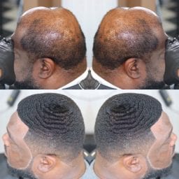 wavy hair replacement