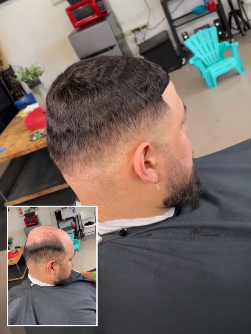 atlanta man weaves before and after