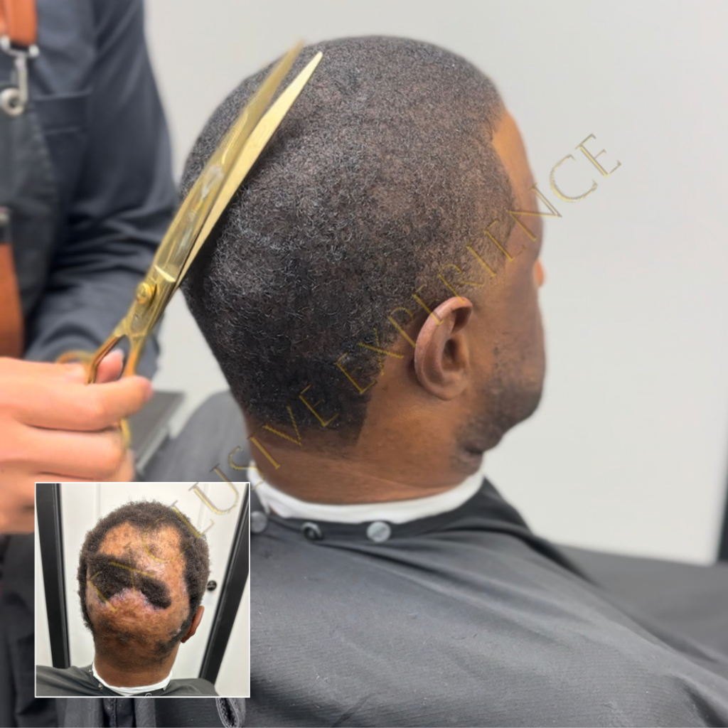 Man weave scar cover