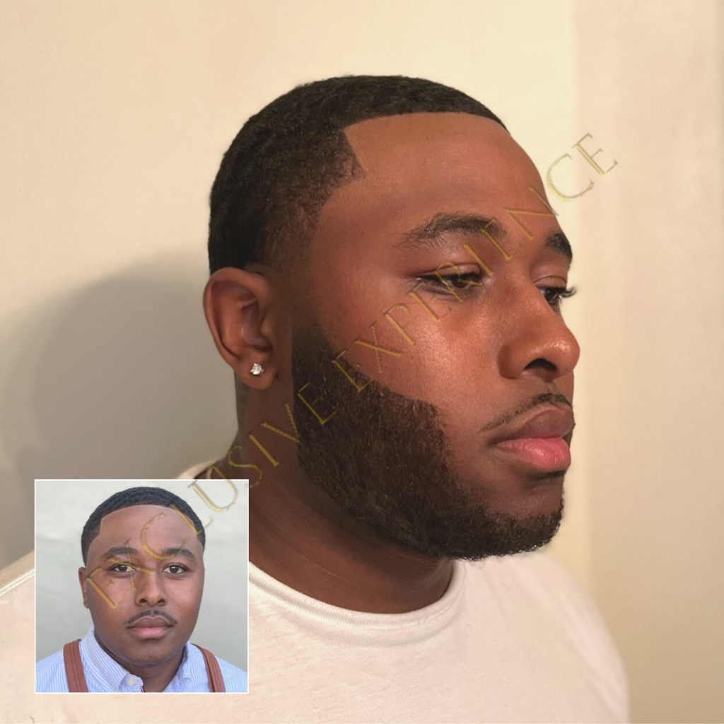 beard unit new orelans