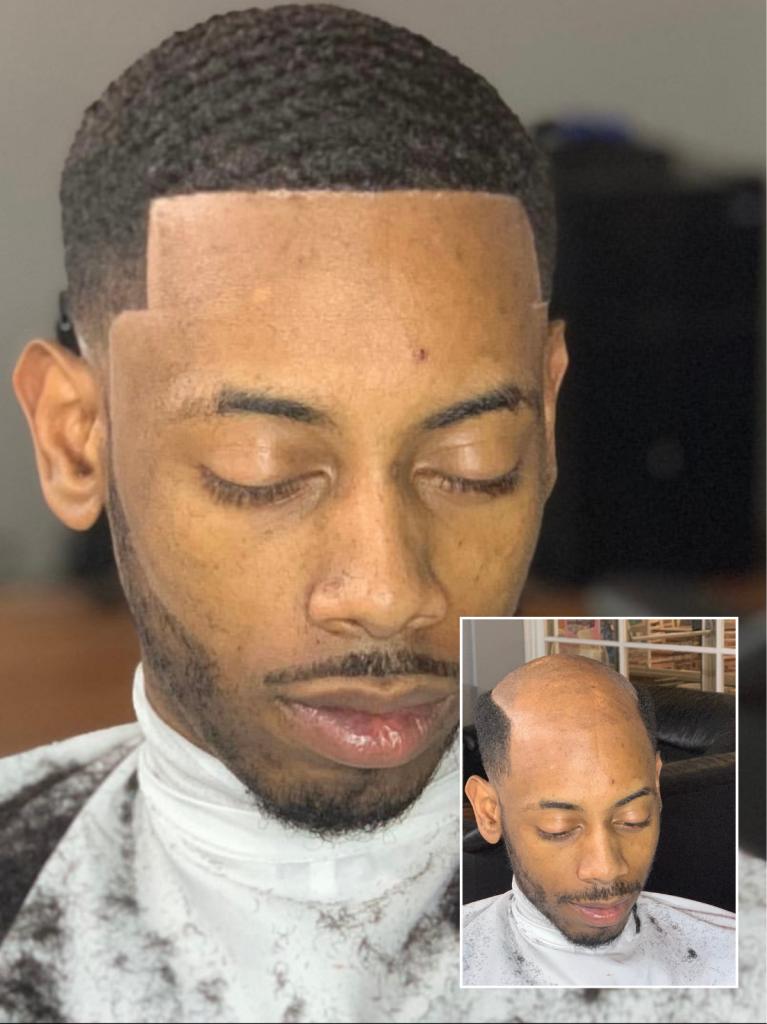 Philadelphia hair units